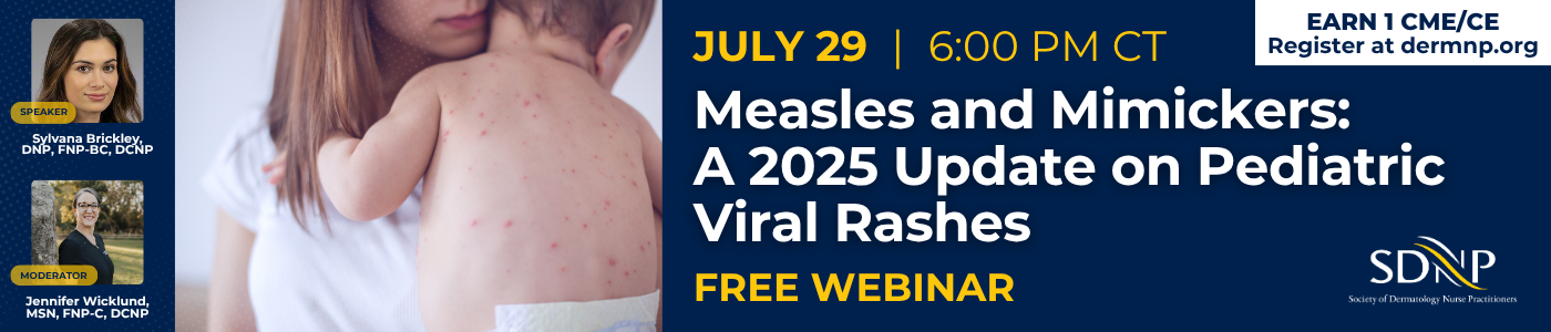 Measles and Mimickers: A 2025 Update on Pediatric Viral Rashes
